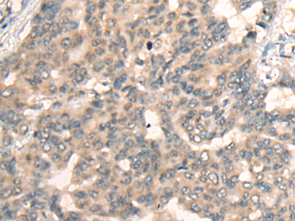 Anti-BBOX1 Rabbit Polyclonal Antibody