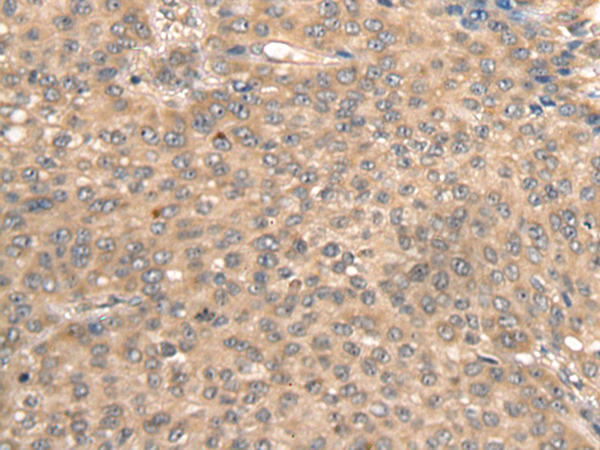 Anti-BBS10 Rabbit Polyclonal Antibody