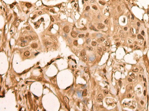 Anti-BRF2 Rabbit Polyclonal Antibody