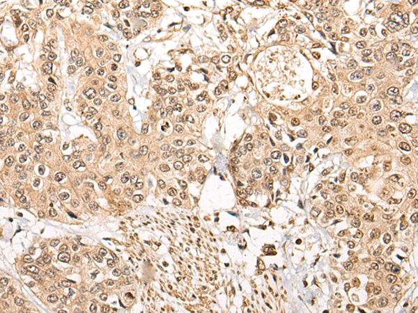 Anti-NCAPH Rabbit Polyclonal Antibody