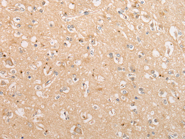 Anti-C15orf40 Rabbit Polyclonal Antibody