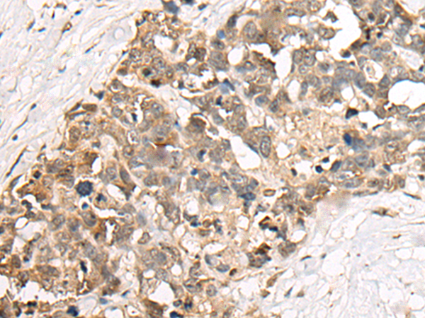 Anti-C1orf19 Rabbit Polyclonal Antibody