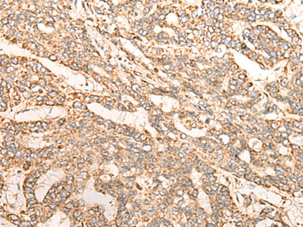 Anti-GATD3B Rabbit Polyclonal Antibody