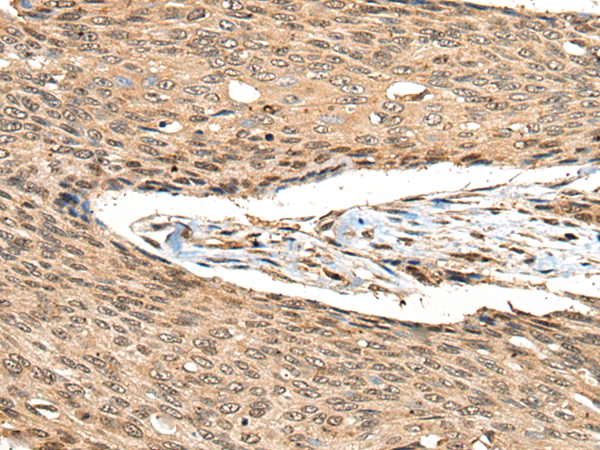 Anti-CAMKK1 Rabbit Polyclonal Antibody