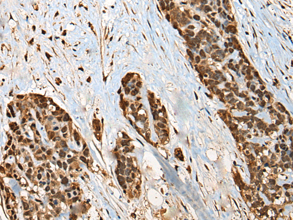 Anti-CASK Rabbit Polyclonal Antibody