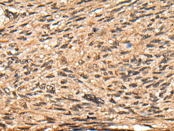 Anti-CBFB Rabbit Polyclonal Antibody