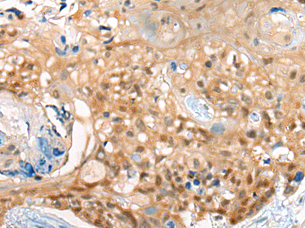 Anti-CBR3 Rabbit Polyclonal Antibody