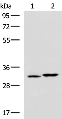Anti-CBR3 Rabbit Polyclonal Antibody