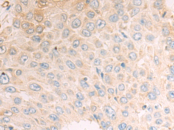 Anti-CDA Rabbit Polyclonal Antibody