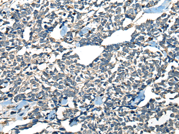 Anti-CDADC1 Rabbit Polyclonal Antibody