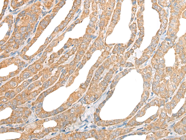 Anti-ACAP1 Rabbit Polyclonal Antibody