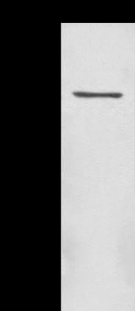 Anti-ACAP1 Rabbit Polyclonal Antibody