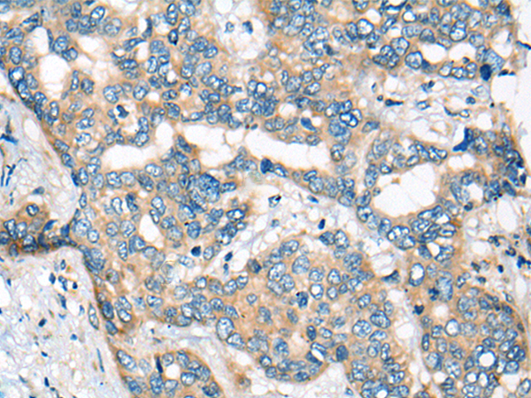 Anti-CEP72 Rabbit Polyclonal Antibody