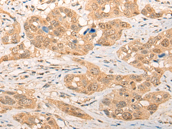 Anti-CEP57 Rabbit Polyclonal Antibody