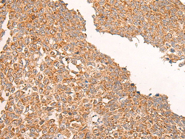 Anti-CHIT1 Rabbit Polyclonal Antibody