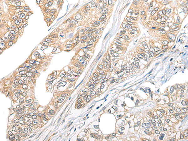 Anti-Tubulin Folding Cofactor B Rabbit Polyclonal Antibody