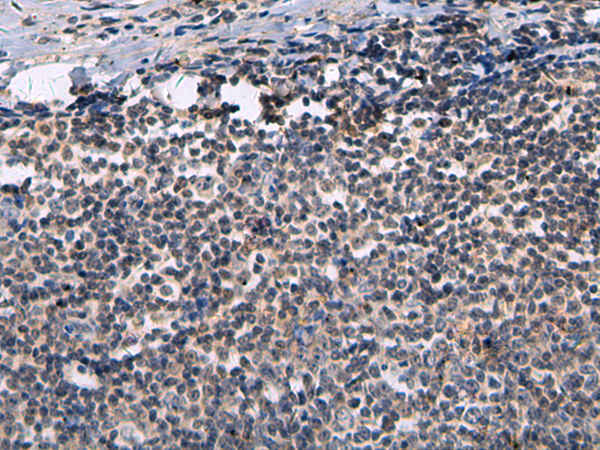 Anti-CLCN7 Rabbit Polyclonal Antibody