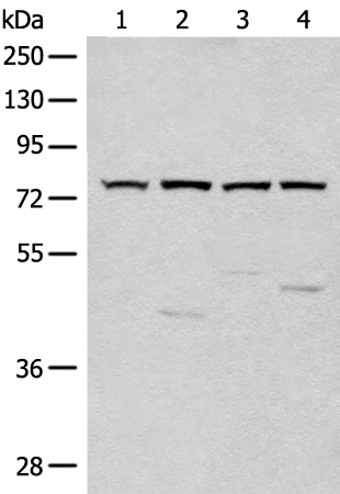 Anti-CLCN7 Rabbit Polyclonal Antibody