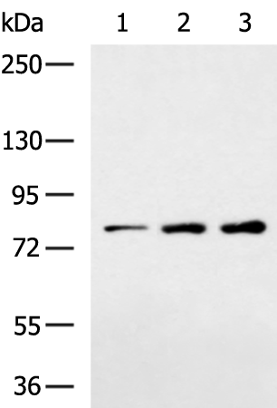 Anti-CLCN7 Rabbit Polyclonal Antibody