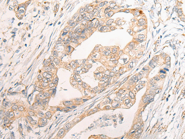 Anti-TRIM39 Rabbit Polyclonal Antibody