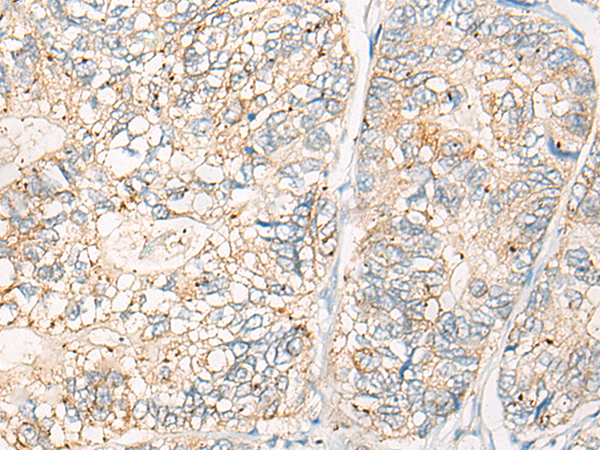 Anti-CRAT Rabbit Polyclonal Antibody
