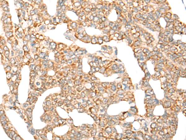 Anti-CYB5R1 Rabbit Polyclonal Antibody
