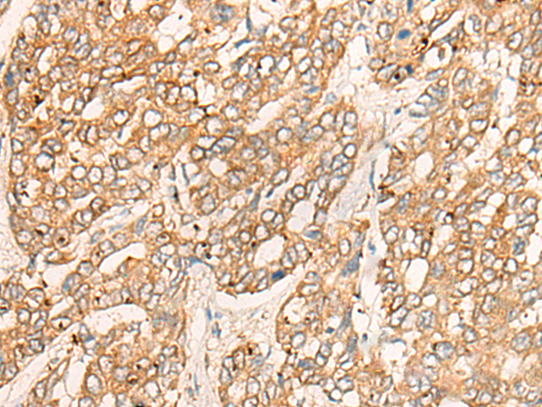 Anti-Cytochrome P450 Reductase Rabbit Polyclonal Antibody