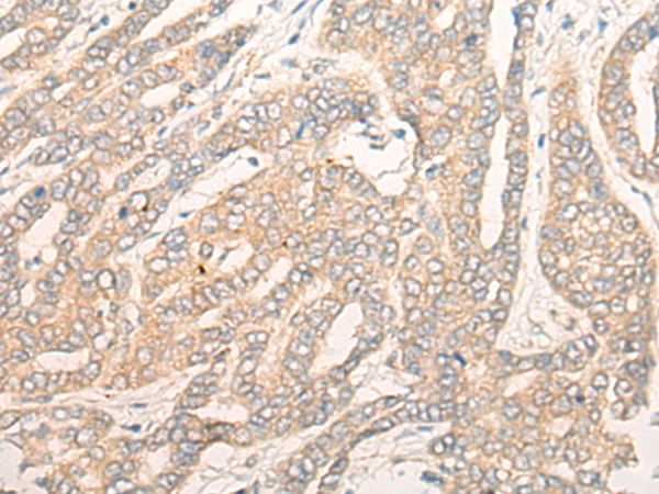Anti-DALRD3 Rabbit Polyclonal Antibody
