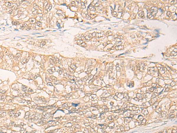Anti-TKFC Rabbit Polyclonal Antibody