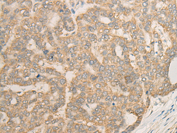 Anti-DDOST Rabbit Polyclonal Antibody