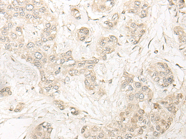 Anti-DDX1 Rabbit Polyclonal Antibody