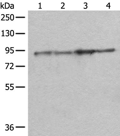 Anti-DDX1 Rabbit Polyclonal Antibody