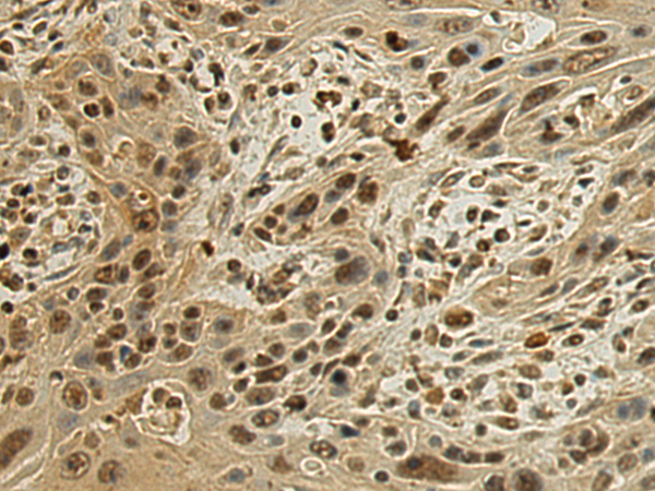 Anti-DDX47 Rabbit Polyclonal Antibody