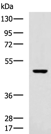 Anti-DDX47 Rabbit Polyclonal Antibody