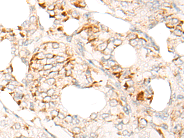 Anti-DDX54 Rabbit Polyclonal Antibody