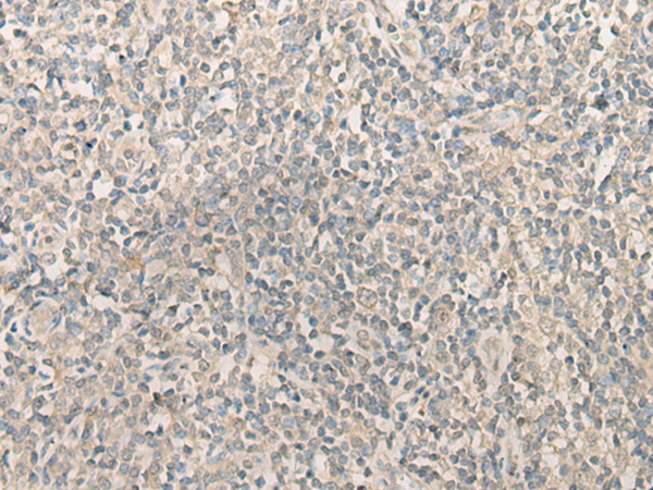 Anti-delta Sarcoglycan Rabbit Polyclonal Antibody