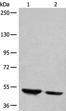 Anti-DENND1B Rabbit Polyclonal Antibody