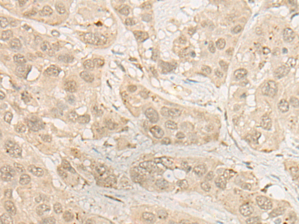 Anti-RSU1 Rabbit Polyclonal Antibody