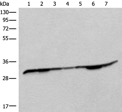 Anti-RSU1 Rabbit Polyclonal Antibody