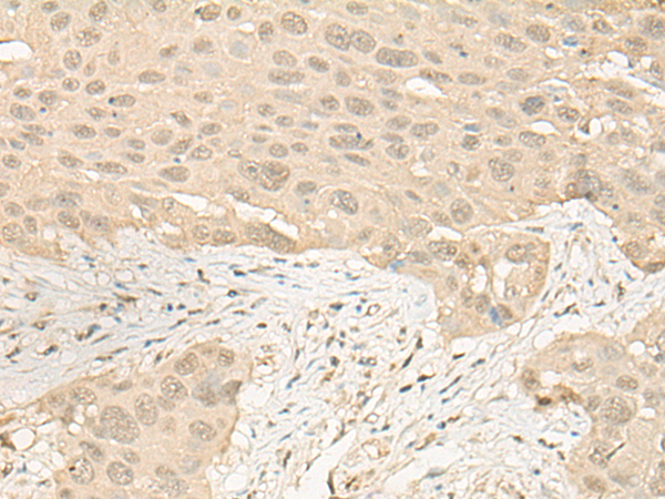 Anti-IMPA1 Rabbit Polyclonal Antibody