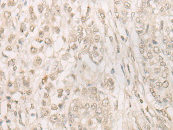 Anti-FSD1 Rabbit Polyclonal Antibody