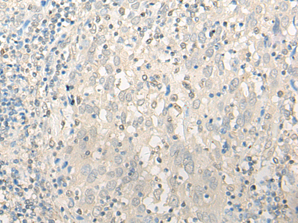 Anti-UBXN1 Rabbit Polyclonal Antibody