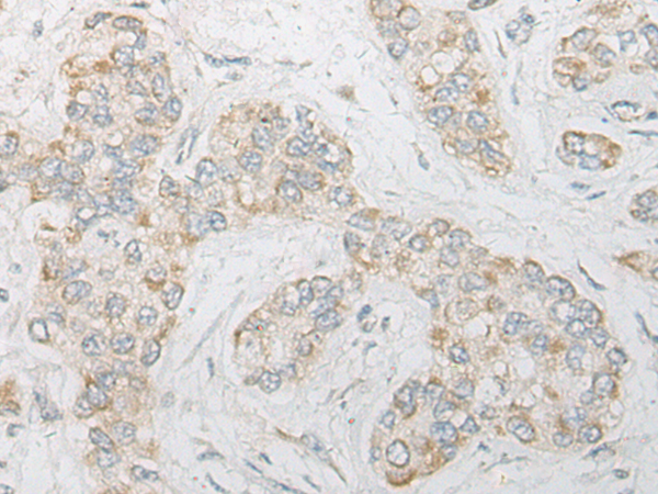 Anti-MAGEA11 Rabbit Polyclonal Antibody