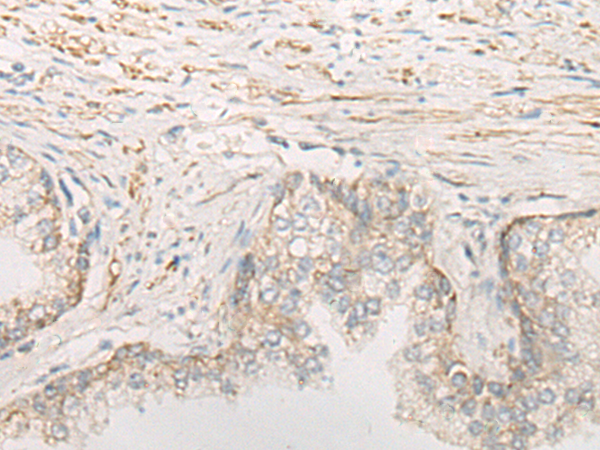 Anti-SLP2 Rabbit Polyclonal Antibody