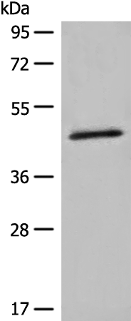 Anti-HMBS Rabbit Polyclonal Antibody