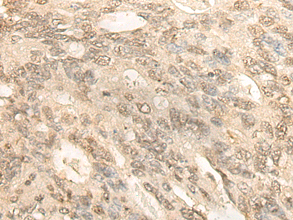 Anti-BCAS3 Rabbit Polyclonal Antibody