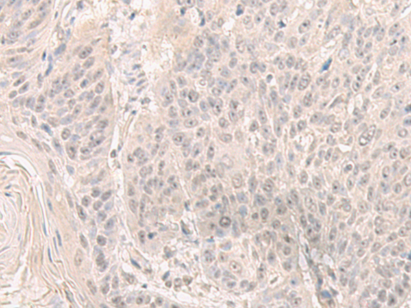 Anti-HENMT1 Rabbit Polyclonal Antibody