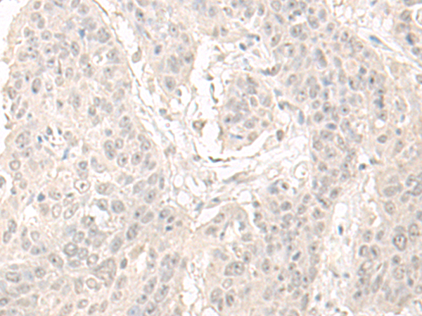 Anti-OLA1 Rabbit Polyclonal Antibody