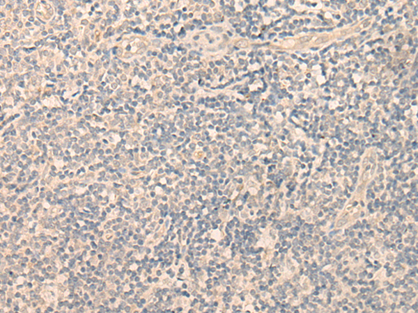 Anti-SPOCK3 Rabbit Polyclonal Antibody