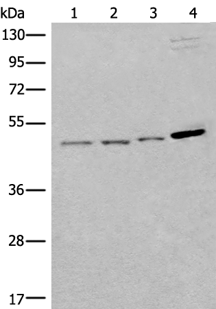 Anti-SPOCK3 Rabbit Polyclonal Antibody